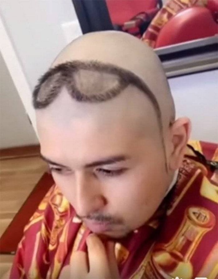 65+ Funniest Haircuts That Will Make You Cringe-07